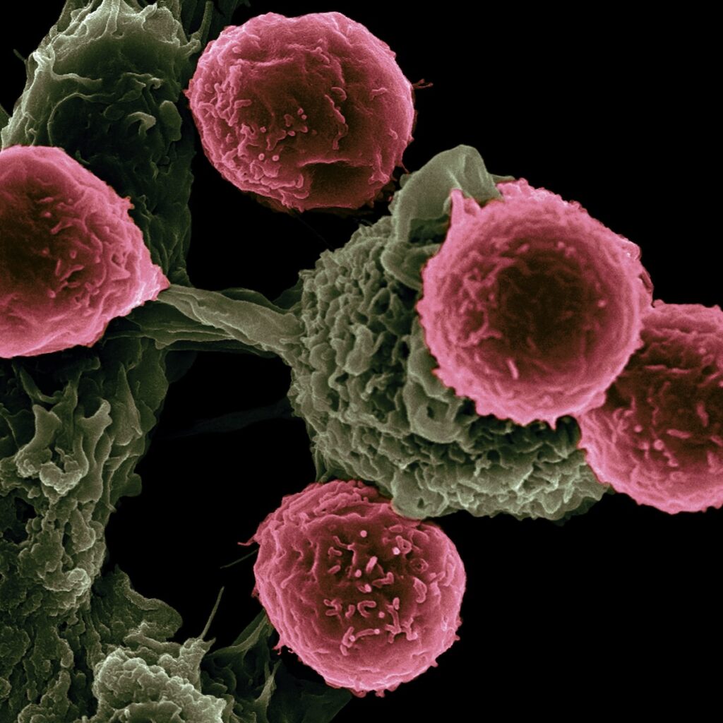 Practical Steps for Health, Cancer Zodiac Sign, Examining Zodiac Traits and Health, Which zodiac sign is most likely to get cancer disease